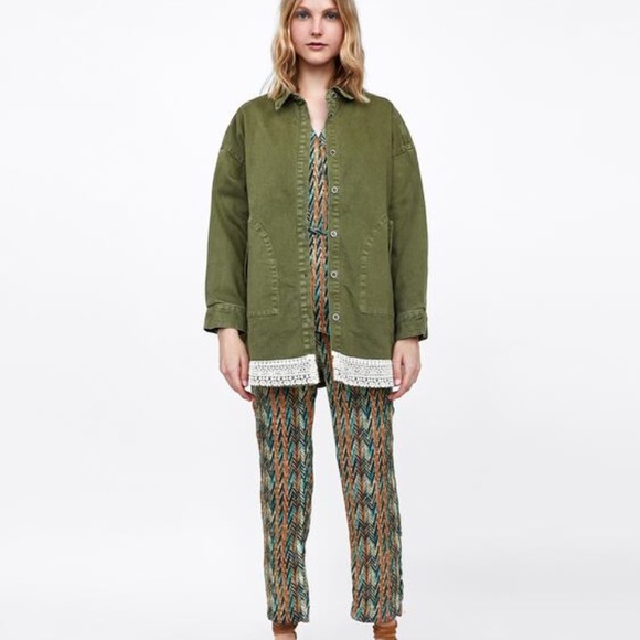 Zara Mixed Lace Overshirt - Picture 4 of 9